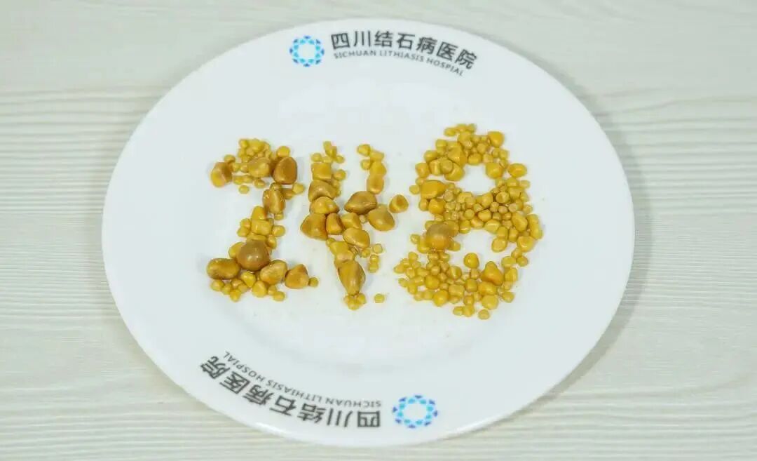 26岁男子体内取出248枚&ldquo;金豆&rdquo;！平常特别爱吃这些&hellip;&hellip;医生郑重提醒