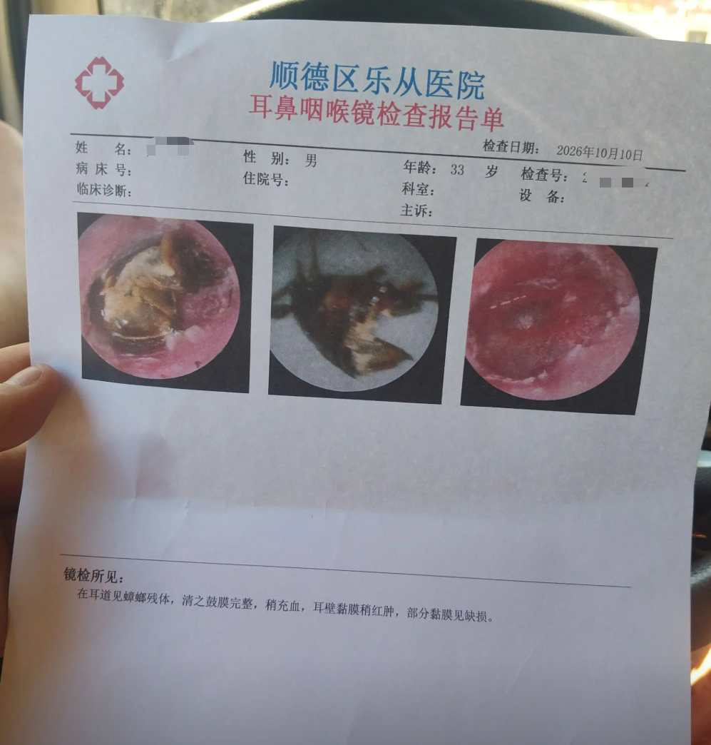 担心的事情发生了！男子睡梦中被蟑螂钻进耳道，近一周后才就医&hellip;&hellip;