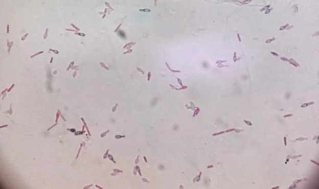 真空包装&ne;绝对安全！多人已中毒，看完赶紧查冰箱&rarr;