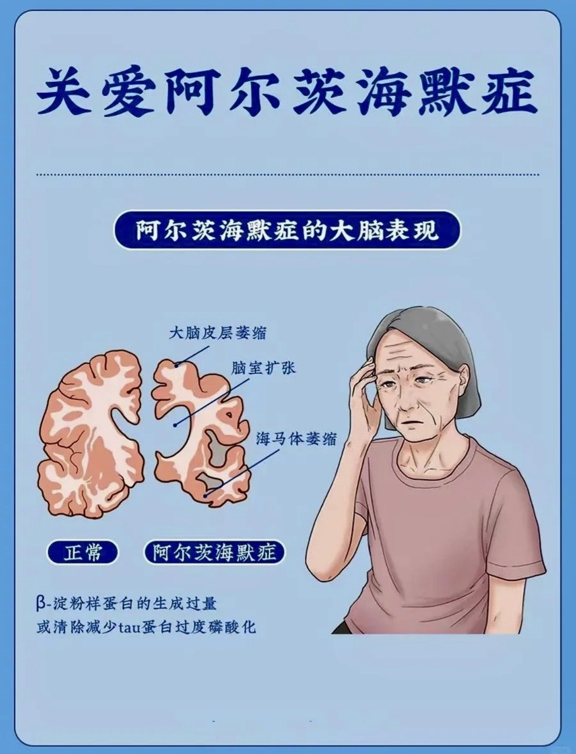 这些习惯可能增加老年痴呆风险