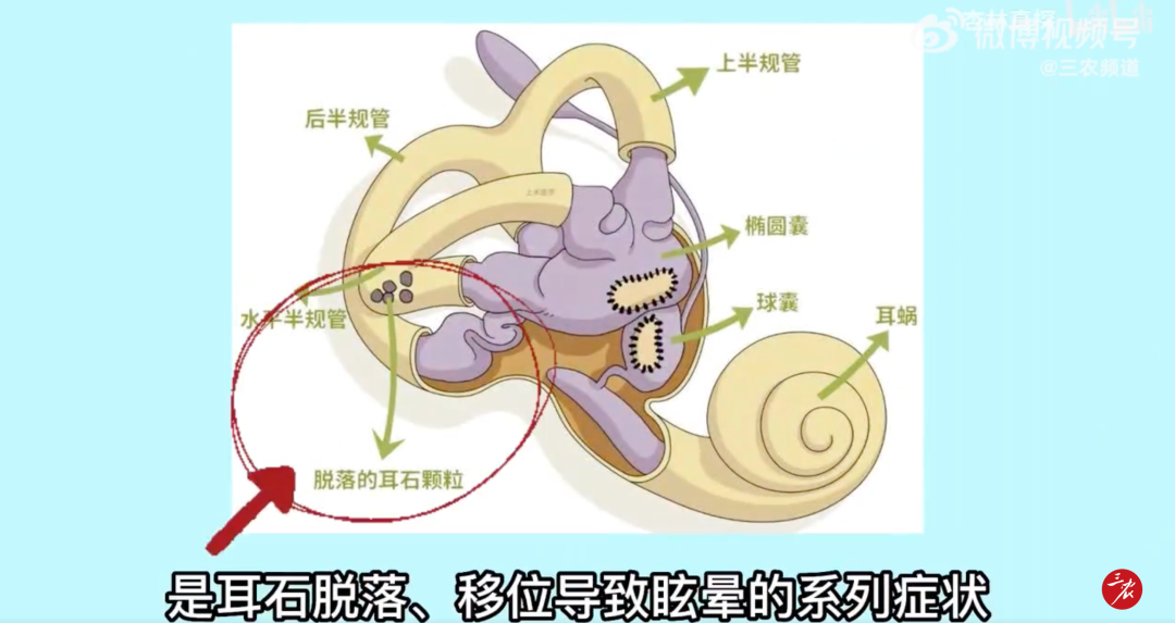 女歌手现场晕倒！这种病正&ldquo;盯&rdquo;上年轻人&rarr;