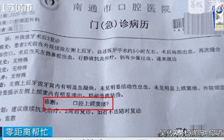 离谱！男子拔牙耗时3小时，后续挂水13天，医院回应让人无语
